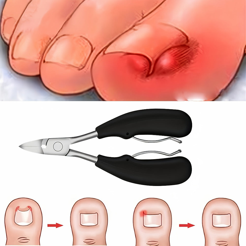 Angled-Jaw Nail Clipper Set, Five-Piece Black-Handle Kit with 25-Degree Tool, Lifter and File — image 2