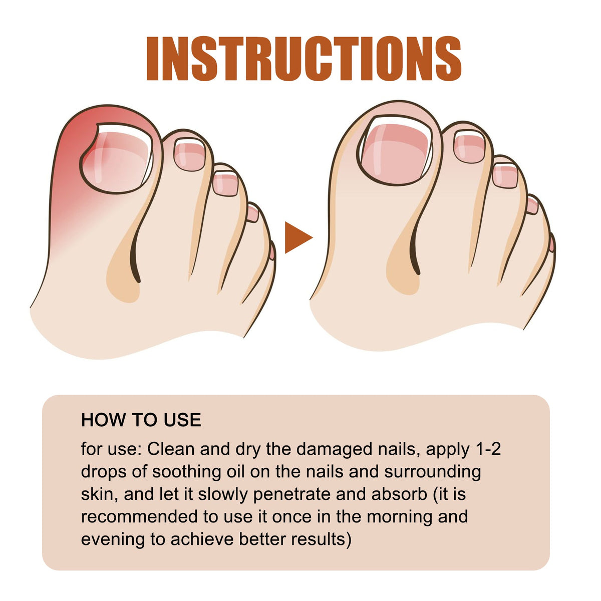 Anti-Nail Groove Relief Oil, Repair Inlaid Nails Gray Nails And Soft Thickening Nail Brightening Nails Care Oil