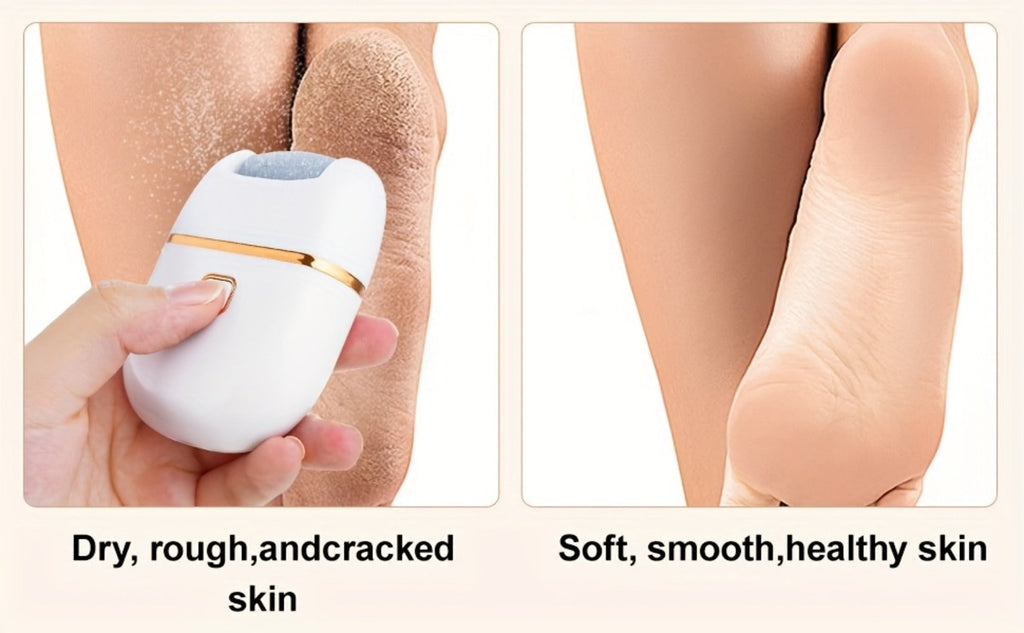 Electric Callus Remover Rechargeable Foot Grinder with 3 Replacement Heads 2 Speed Settings IPX5 Waterproof USB Charging Port
