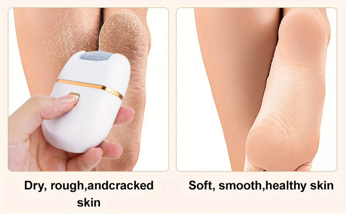 Electric Callus Remover Rechargeable Foot Grinder with 3 Replacement Heads 2 Speed Settings IPX5 Waterproof USB Charging Port