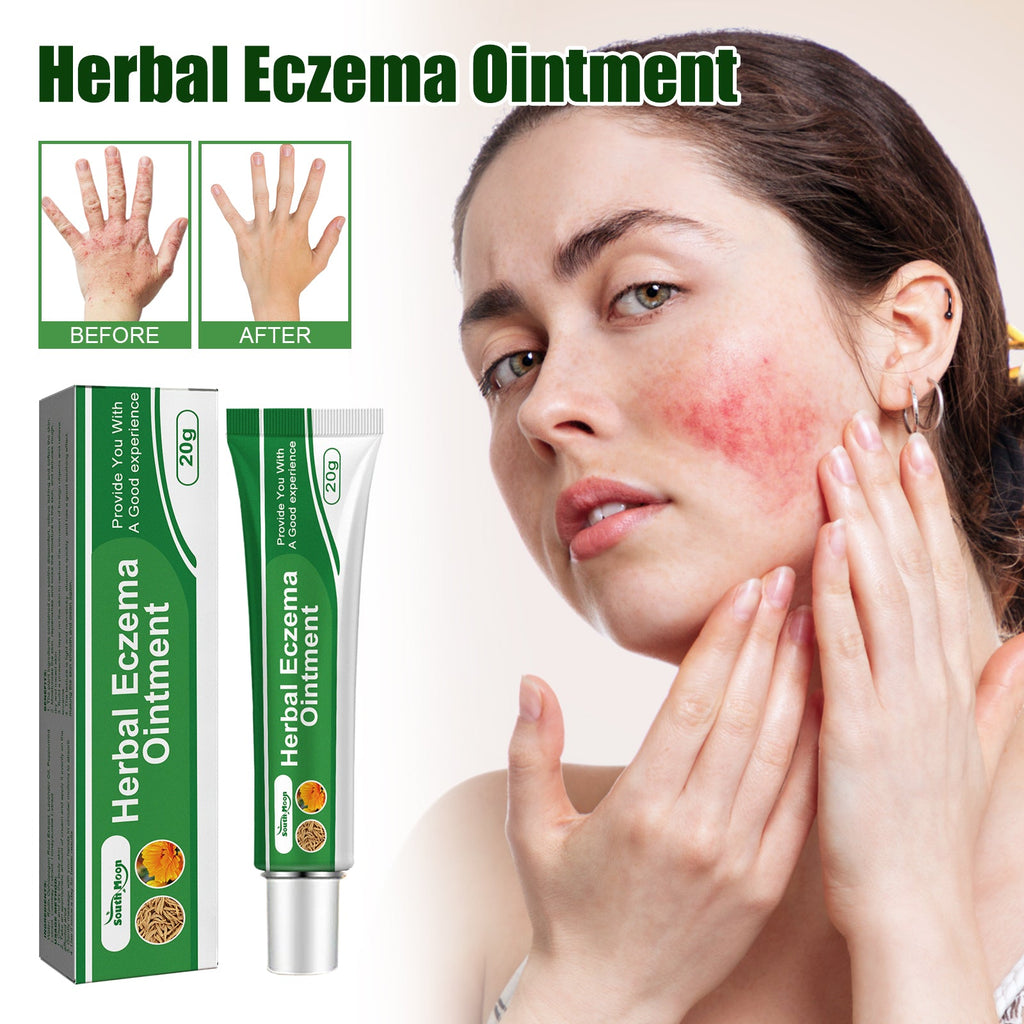 Herbal Eczema Ointment, Relieve Hand And Foot Moss Skin Redness Itchy Skin Repair Ointment - V.I.P Digital Presence