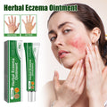 Herbal Eczema Ointment, Relieve Hand And Foot Moss Skin Redness Itchy Skin Repair Ointment - V.I.P Digital Presence
