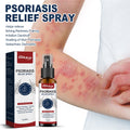 Psoriasis Relief Spray, Relieve Skin, Hands And Feet Redness Peeling Itch Repair External Care - V.I.P Digital Presence
