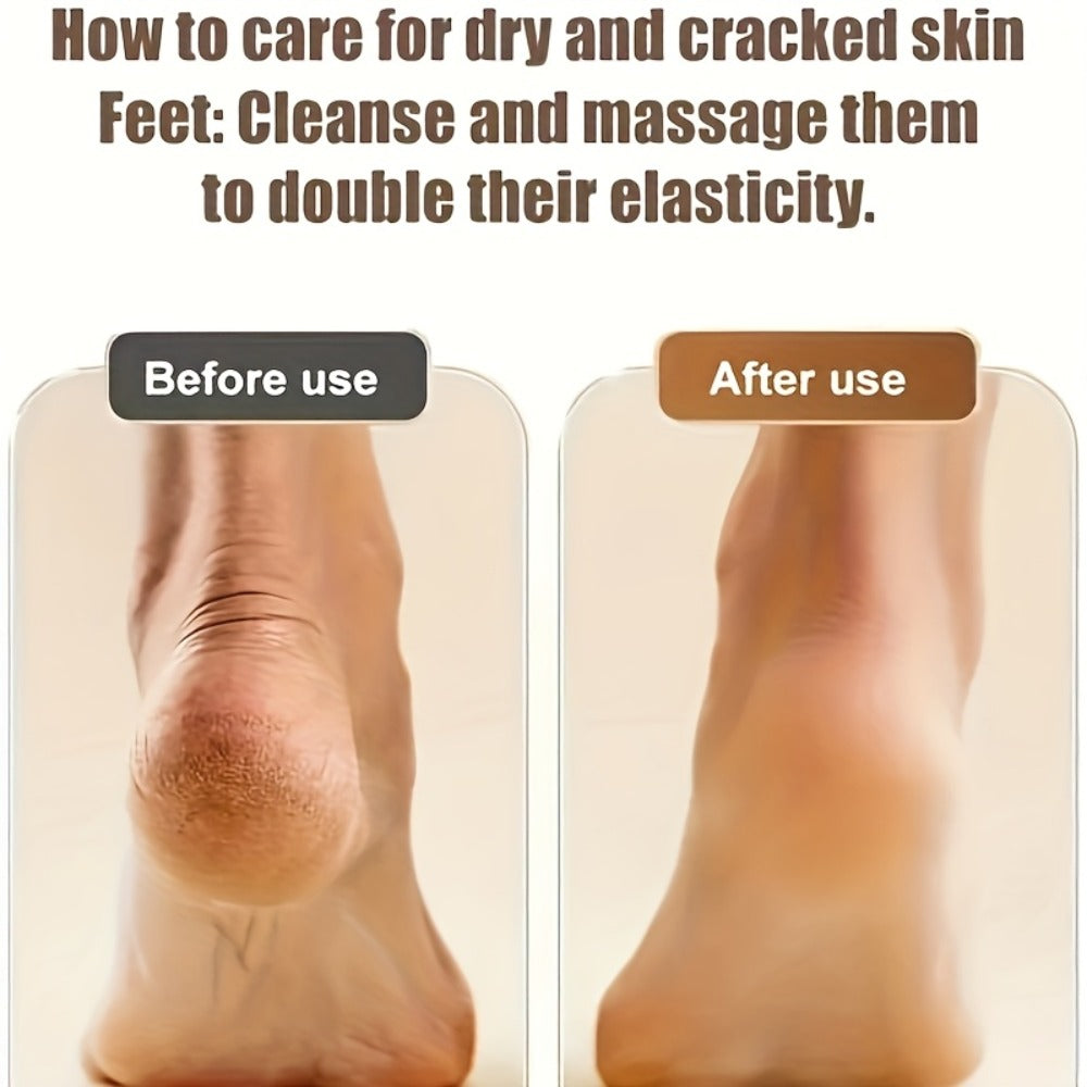 Electric Callus Remover Rechargeable Foot Grinder with 3 Replacement Heads 2 Speed Settings IPX5 Waterproof USB Charging Port