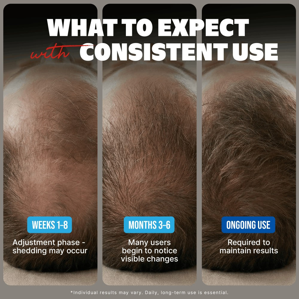 Minoxidil 5% Extra Strength Topical Solution for Men Hair Regrowth - Kirkland Signature 6-Month Supply — image 5