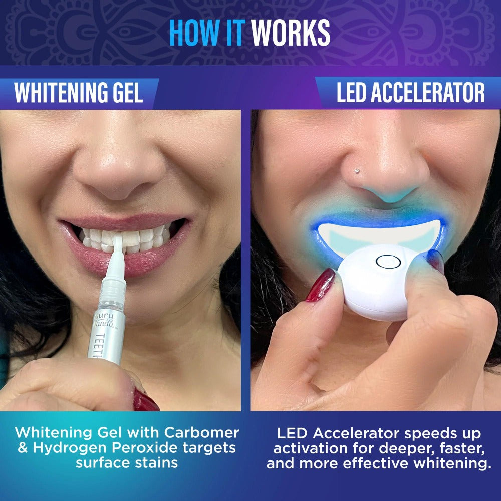 Wireless 16-LED Teeth Whitening Mouthpiece Kit with Two Gel Pens, Cleaning Case and Accessory Packs — image 3