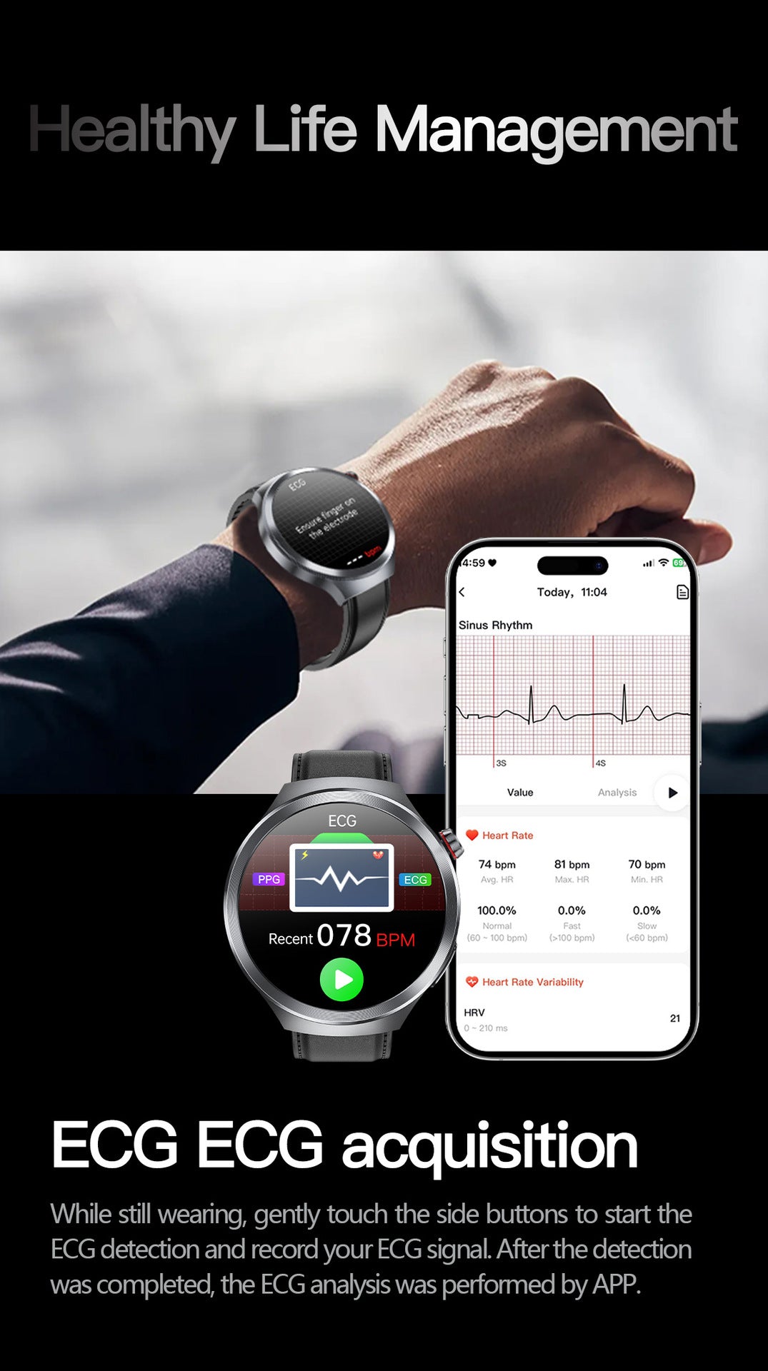 Smart Watch AMOLED Screen ECG Heart Rate Pressure Blood Oxygen Health