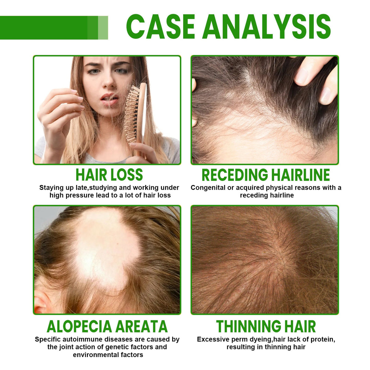 Hair Root Spray, Repair Dry Hair Fickle Hair Tight Hair To Prevent Smooth Hair