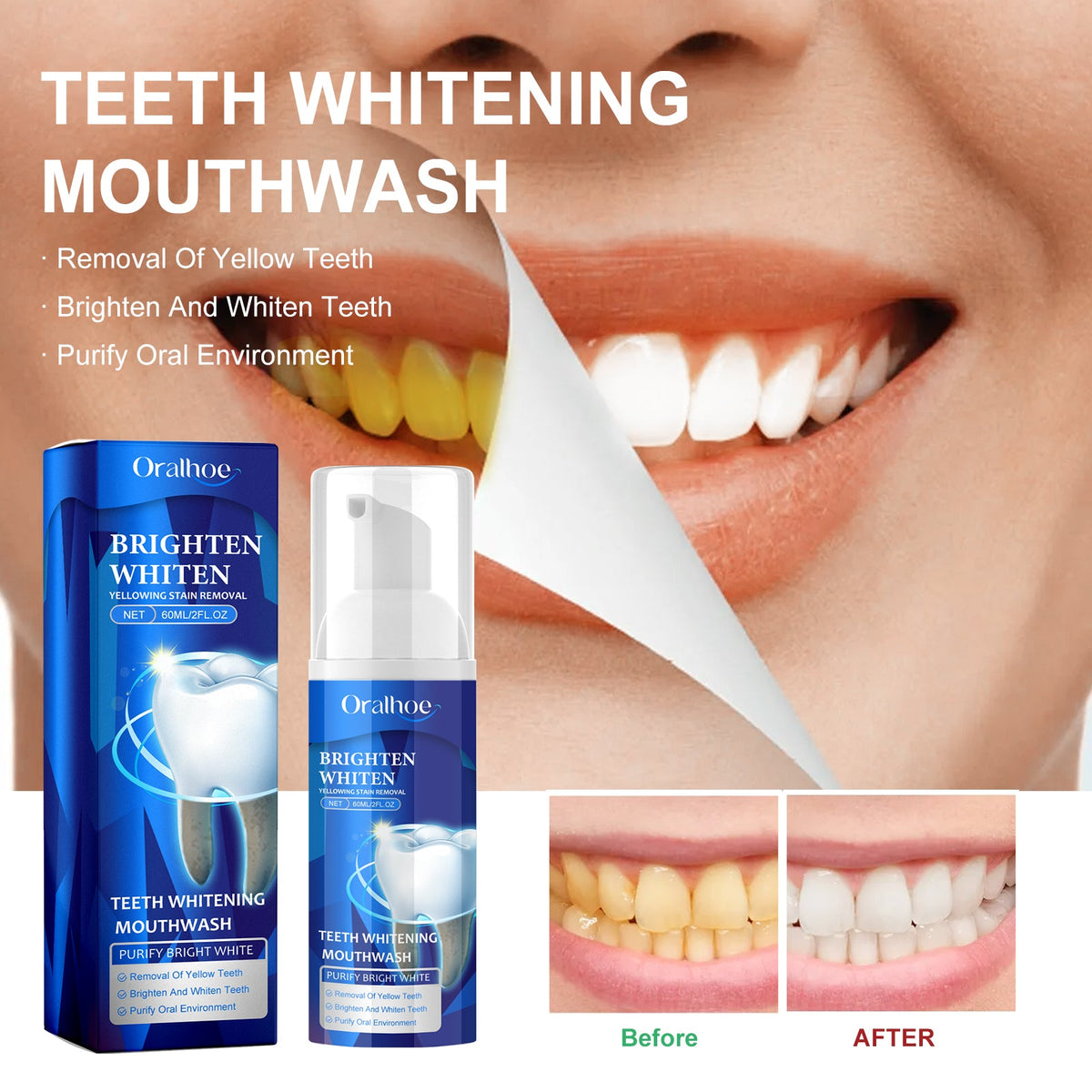 Teeth Whitening Mouthwash, Teeth Cleaning Teeth Yellow Stains Tartar Beauty Teeth Fresh Breath Oral Care