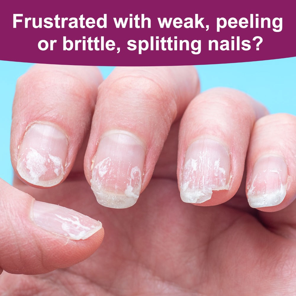 Nail Fortifier & Hardener 10ml Protective Strengthening Agent for Weak Damaged Brittle Nails – Makes Nails Stronger Tougher &