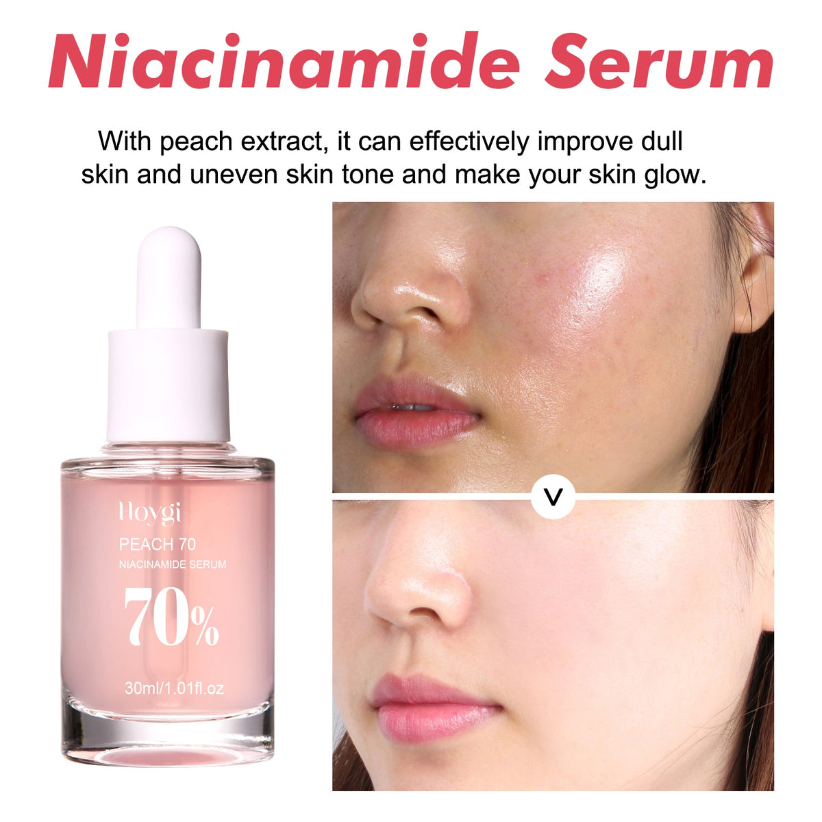 Nicotinamide Essence Tights And Moisturizes Pores, Lighens Acne Marks And Spots, Moisturizes And Brighens Skin