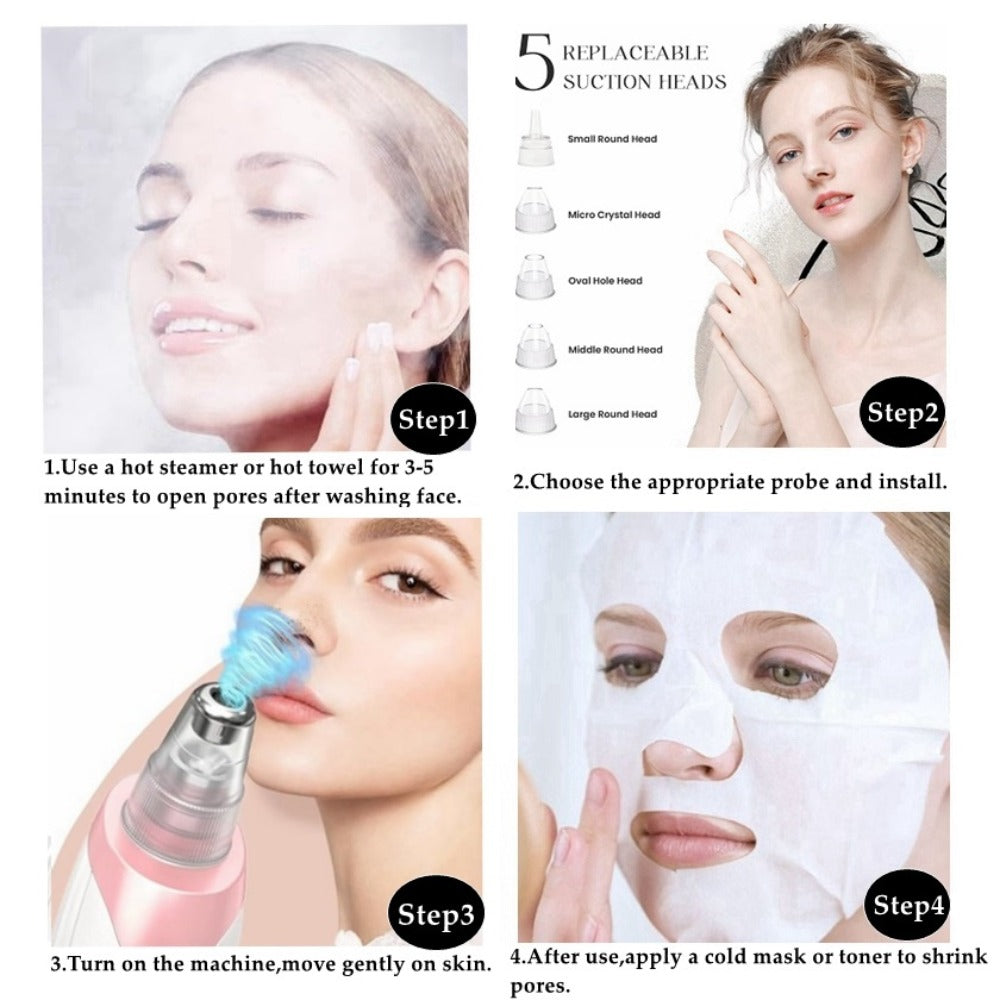 Pink Pore Vacuum Blackhead Remover with 3 Suction Levels, 5 Heads and 4 Manual Extractor Tools — image 12