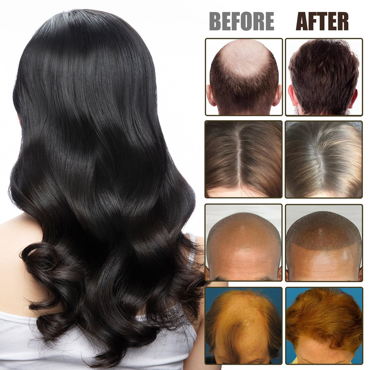 NMN Scalp Cell Revitalizing Hair Essence, Hair Care Strengthen And Strengthen Hair Repair Hair Root Thickening Hair Moisturizing Essence