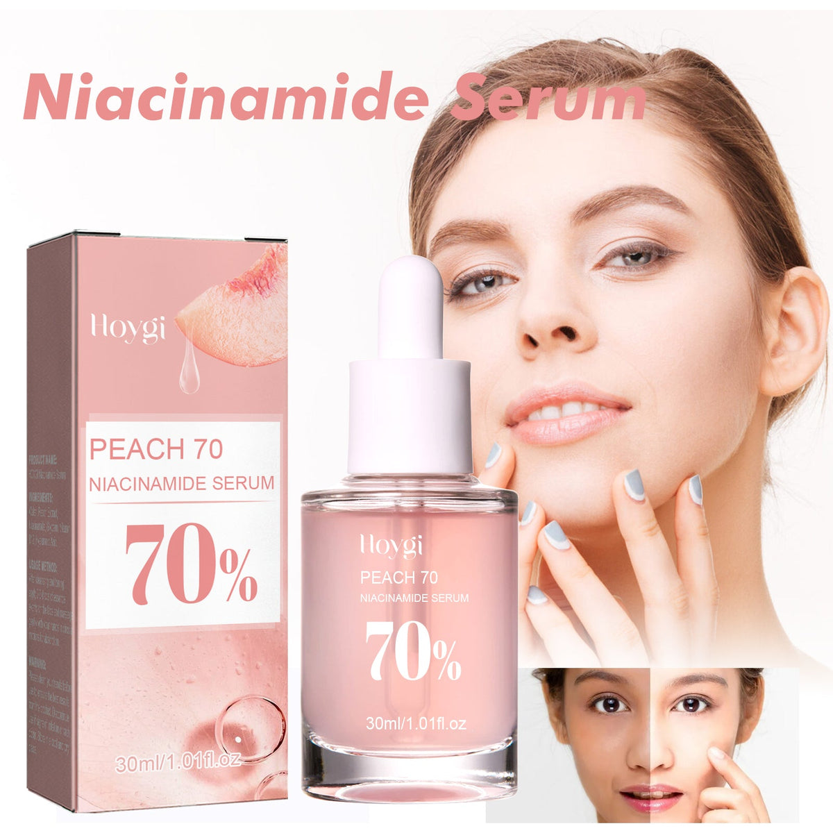Nicotinamide Essence Tights And Moisturizes Pores, Lighens Acne Marks And Spots, Moisturizes And Brighens Skin
