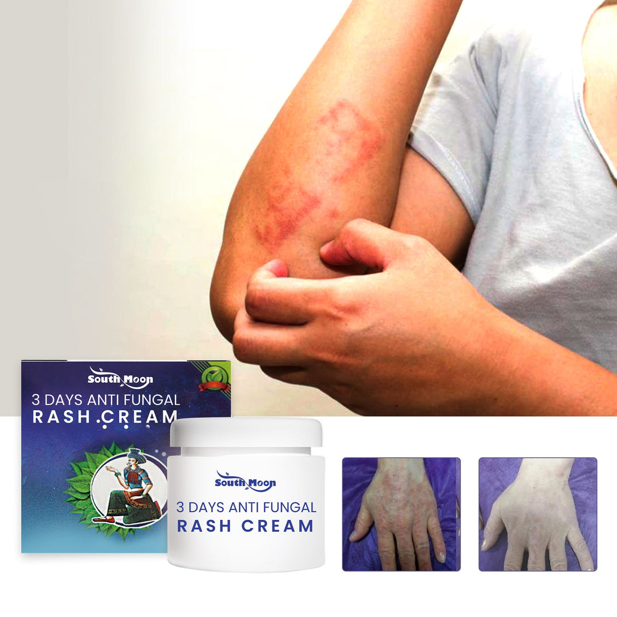 3 Days Aati Fungal Rash Cream, Repair Skin Barrier Soothe Moss Redness And Itchiness Moisturizing Skin Care Cream - V.I.P Digital Presence