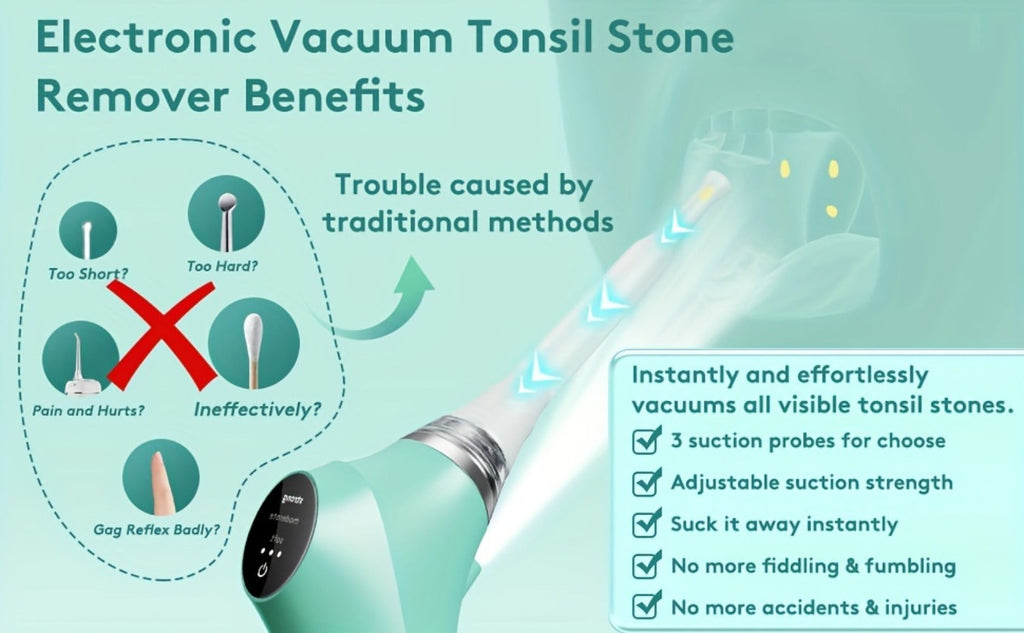 Tonsil Stone Remover Electric Vacuum Kit with LED Light – 3 Suction Modes 5X Magnifying Mirror Oral Irrigator Safe Gentle Ton
