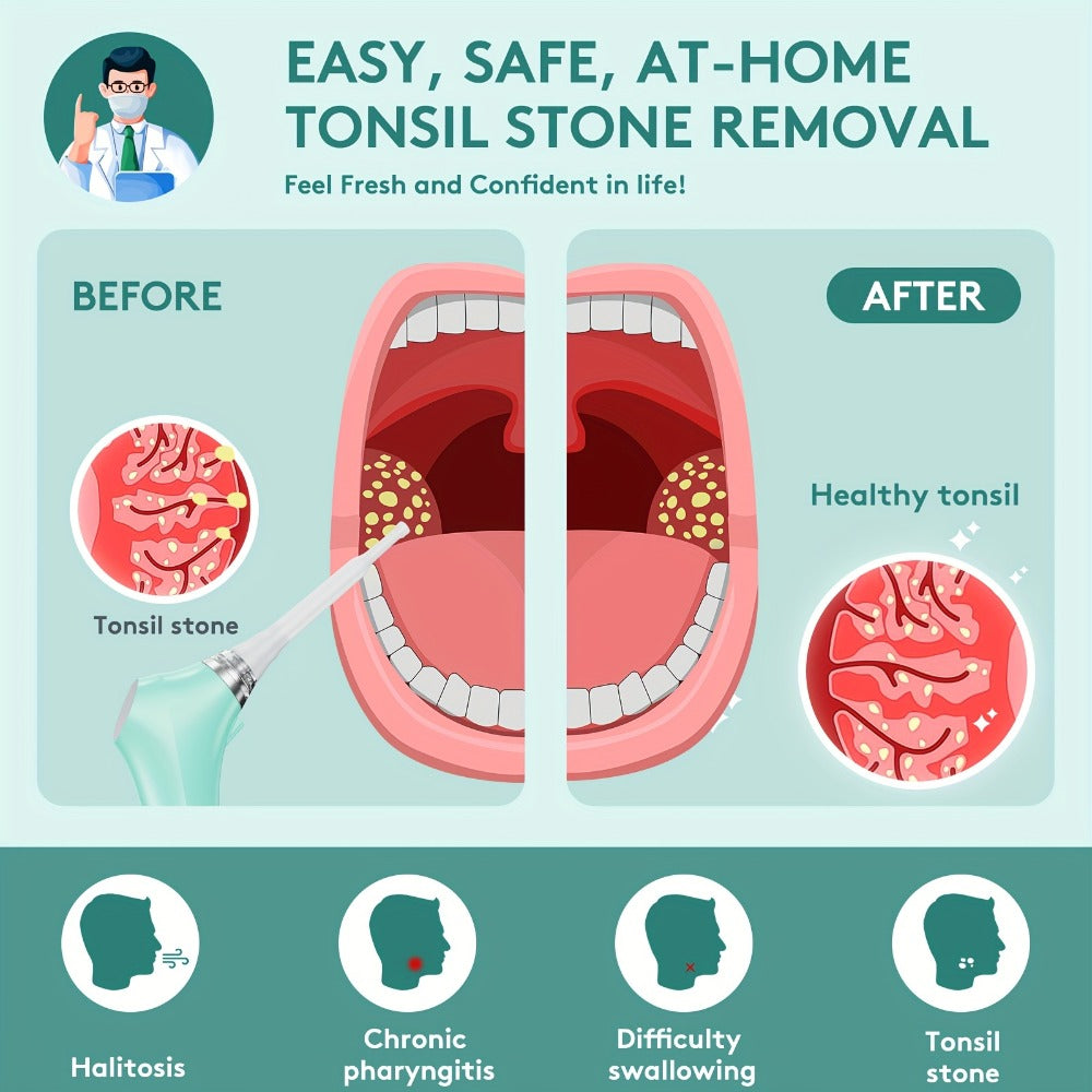 Tonsil Stone Remover Electric Vacuum Kit with LED Light – 3 Suction Modes 5X Magnifying Mirror Oral Irrigator Safe Gentle Ton