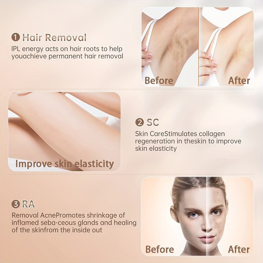 Sarisili AI01-12 IPL Hair Removal Device with Cooling Contact Area, Nine Levels and Manual or Auto Modes — image 6